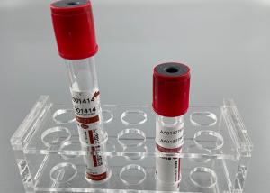 Best No Anticoagulant 2ml Blood Vacuum Container Common Rapid Serum Tube wholesale