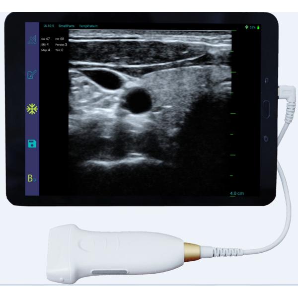 Probe Type Mini Portable Ultrasound Scanner USB Array Linear CE Approval