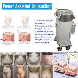 China BS-LIPS5 cannula sales body slimming power assisted liposuction machine on sale