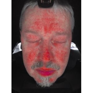 Best Facial Skin Scanner Analysis , Skin Analyzer Machine With Ce Certificate wholesale