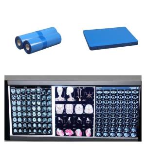 Medical Inkjet X Ray Films For CT MRI DR CR Image Output Compatible With HP Printer