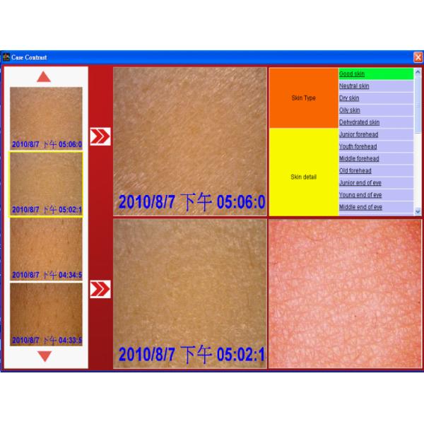 skin analysis1 (1).png