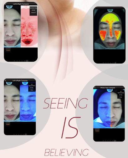 UV Scanner Visia Skin Analysis System Facial Handheld Equipment