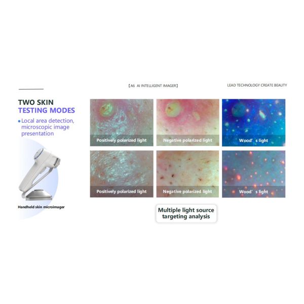 GMS- A6 Al Intelligent Face Analyzer Machine 15 Skin Problems Analysis With 8 Spectral Imaging Technologies