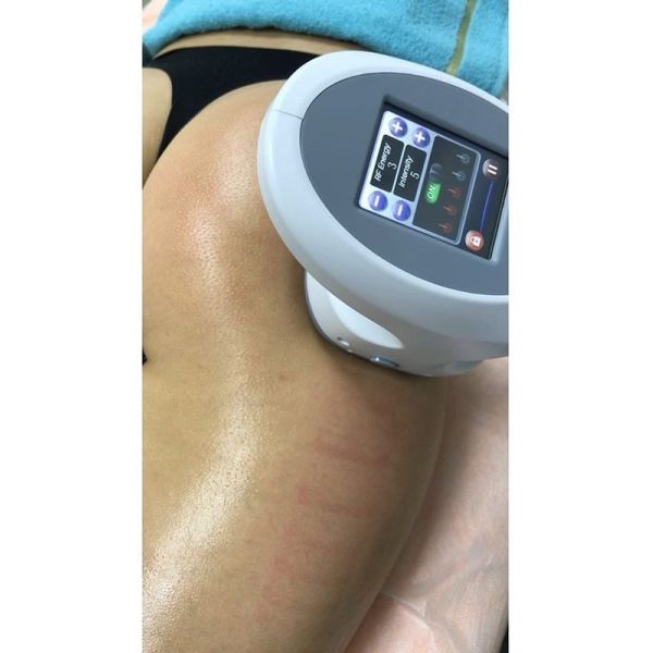 Cavitation Rf Slimming Machine