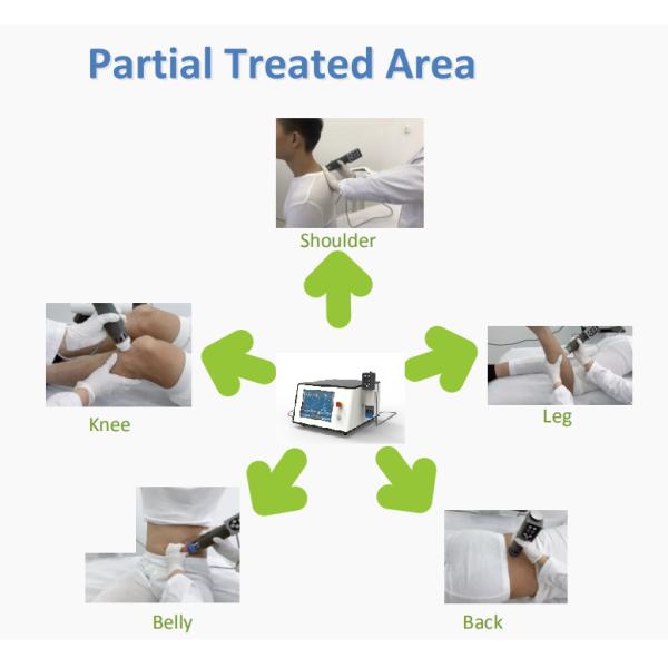 Focus Shockwave Therapy Machine 200W ESWT Therapy Machine With ED Treatment