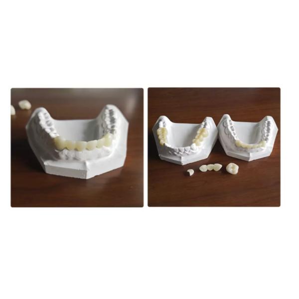 4 axis CAD/CAM 5 axis dental milling machine for zirconia PMMA WAX/Cleaning & Filling Teeth Equipments