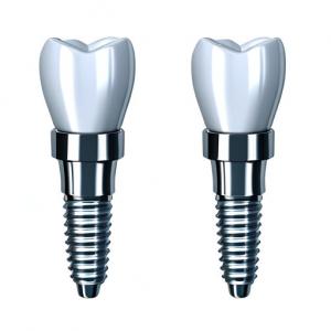 Best Consistency In Every Crown Our Dental Implant Crown Manufacturing Process wholesale
