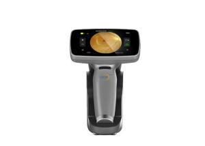 Best Wifi APP Digital Fundus Camera With Internal Capacity 16GB wholesale