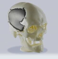 Professional SLS 3D Printing Service Customized Plastic Parts For Medical  Products