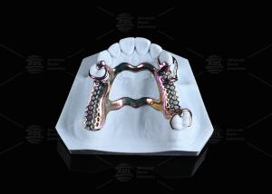 Best Sensitive Skin High Strength Titanium Framework Solution 3D Printed wholesale