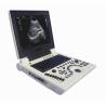 Buy cheap USG OB GYN Portable USG Machine IMT Automatic Measurement from wholesalers