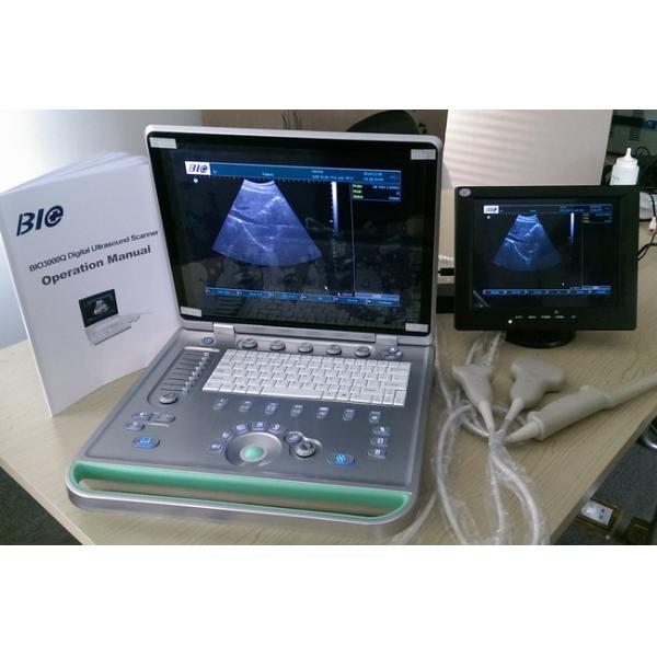 3D Digital Laptop B / W Portable Ultrasound Scanner With Convex Linear Transvaginal Probes