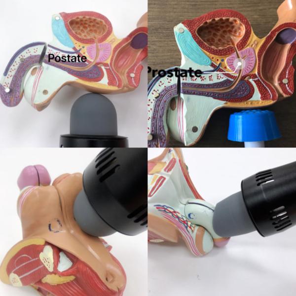 Vacuum Shock Wave Physiotherapy Machine Cellulite Reduction