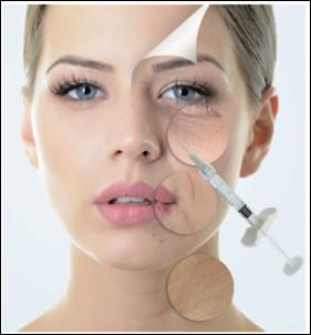 Cheap 1ml 1.1ml Cross Linked Hyaluronic Acid Dermal Fillers For Nose Midface Cheek for sale