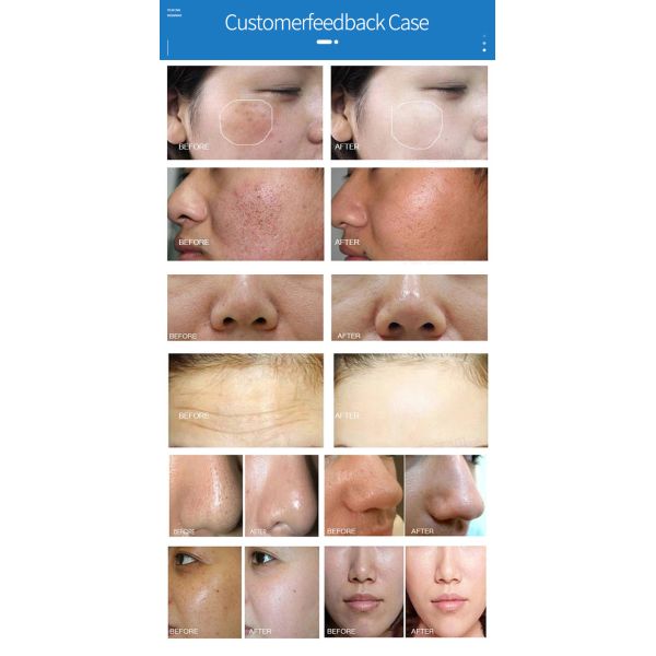 Skin Cleaning Hydrafacial Beauty Machine 7 In 1 Diamond Oxygen Jet Peel Machine