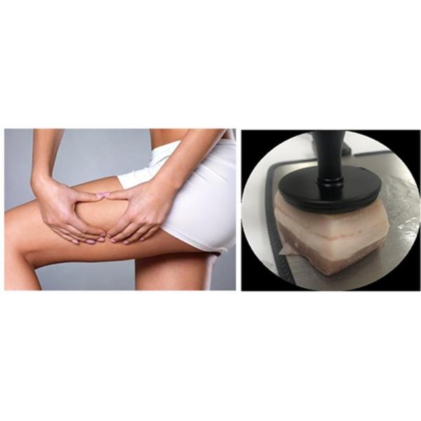 10.0 Body Massage RF Tecar Therapy Machine With Double 80MM Handle