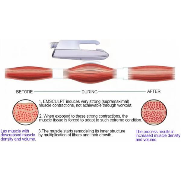 Commercial Use Ems Slimming Machine Iso Certification