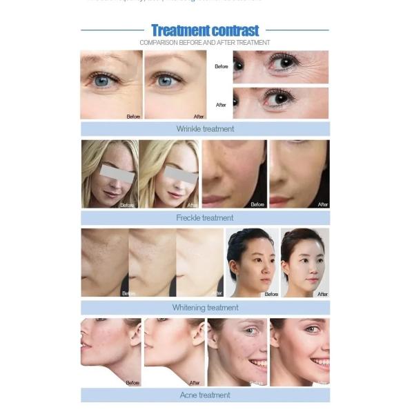 Mesotherapy Gun No-Needle Device Water Oxygen Jet Wrinkle Removal Machines