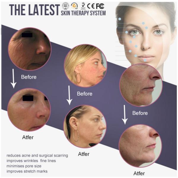 Durable Permanent Makeup Machine , Recharging Auto Derma Microneedle Therapy Machine