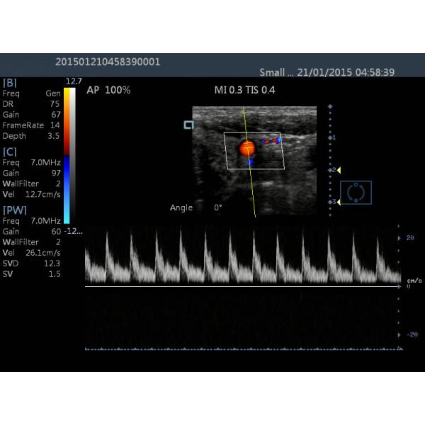 15 Inch Touch LCD 2D Ultrasound Color Dopple Machine Portable Diagnostic Ultrasound Device