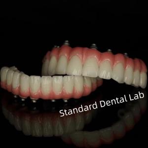China Implant Screw Cement Retained Dental Restorations from Standard Dental Lab on sale