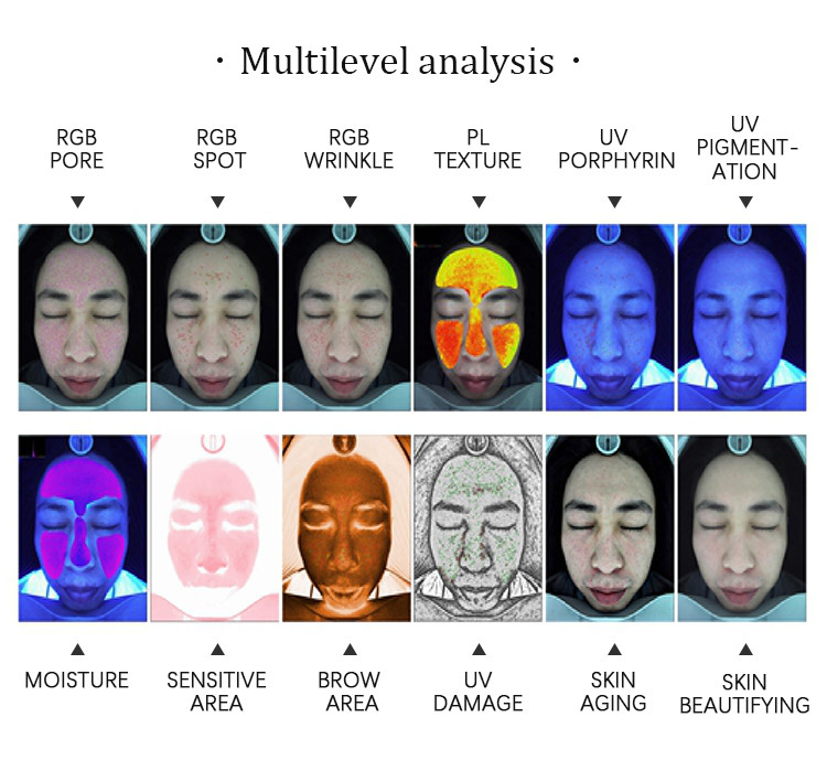 Acne Treatment 3D Skin Analyzer / 9000h Smart Mirror Skin Analysis System