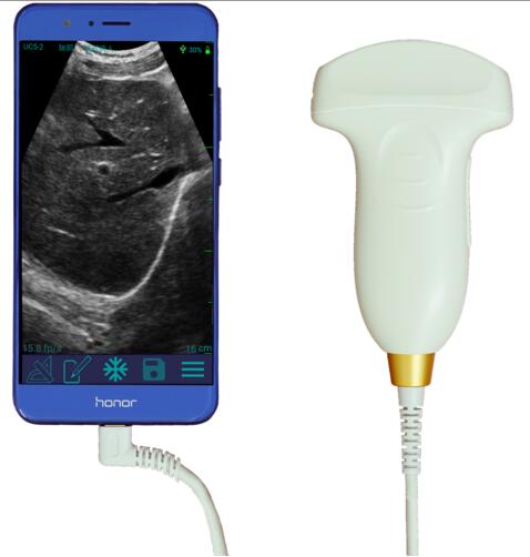 Probe Type Mini Portable Ultrasound Scanner USB Array Linear CE Approval