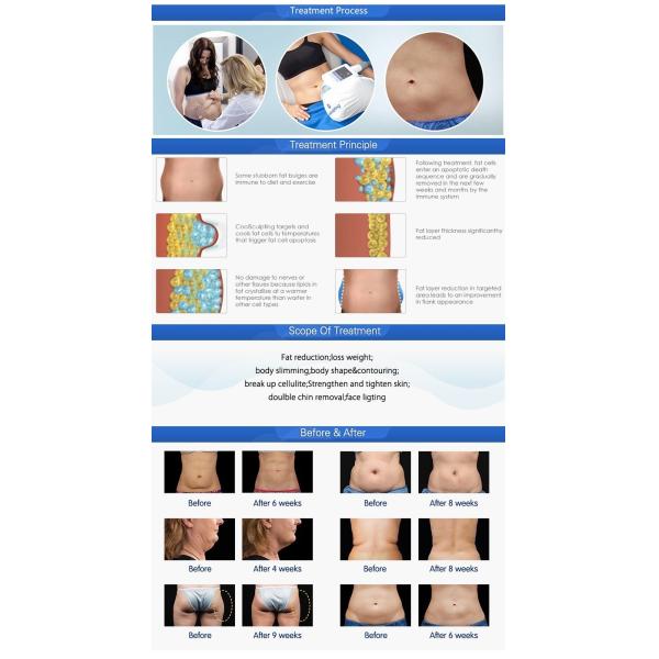 2 handles working simultaneously cool body shaping cavitation rf slimming fat freezing cryolipolysis machine