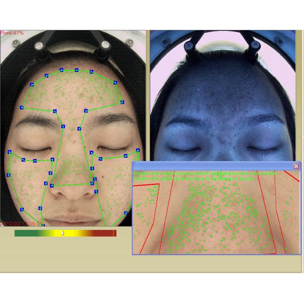 18 Million Facial Scanner Skin Analyzer Machine With 10 Inch Screen