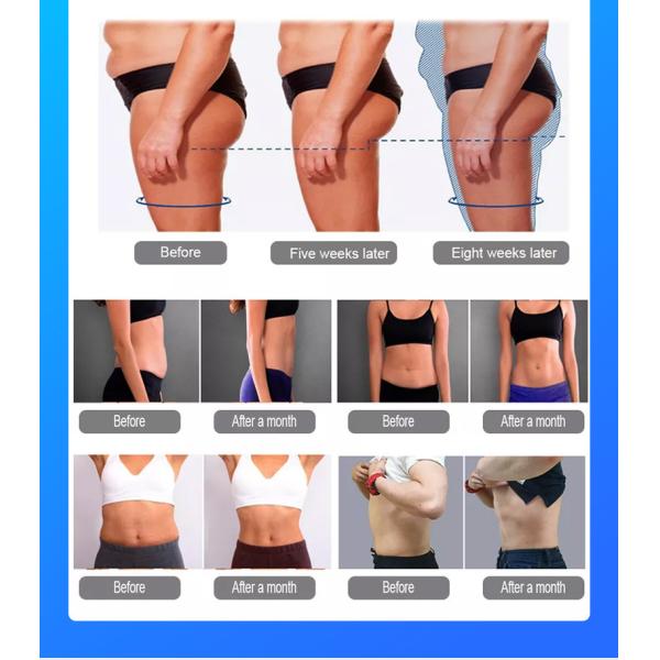 Ultrasonic Muscle Sculptinging Machine Zero Roller RF Body Slimming 13 Tesla