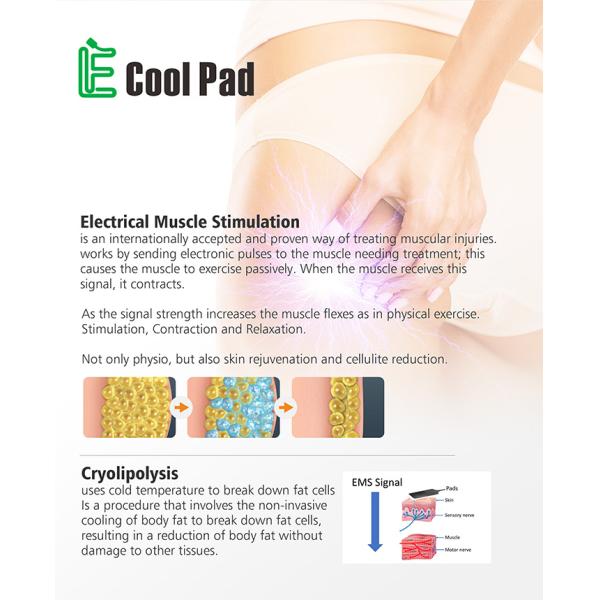 Mobile Cool Slimming Machine -5℃~10℃ Temperature Range Convenient Use