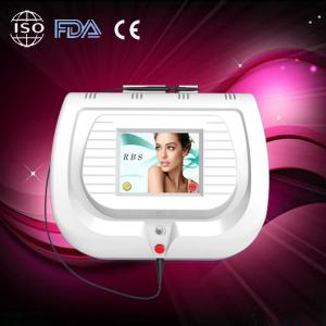 Profesional 30MHZ acne treatment vascular spot removal