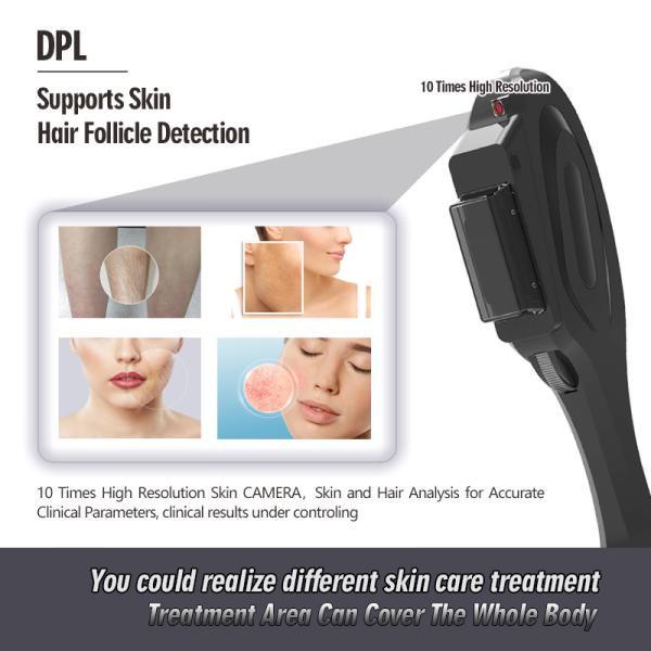 OPT Technology Hair Removal Machine Power 3500W With DPL Function