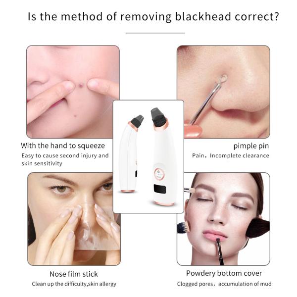 Rechargeable Blackhead Remover Machine Electric Pore Cleaner Suction Easy Operation