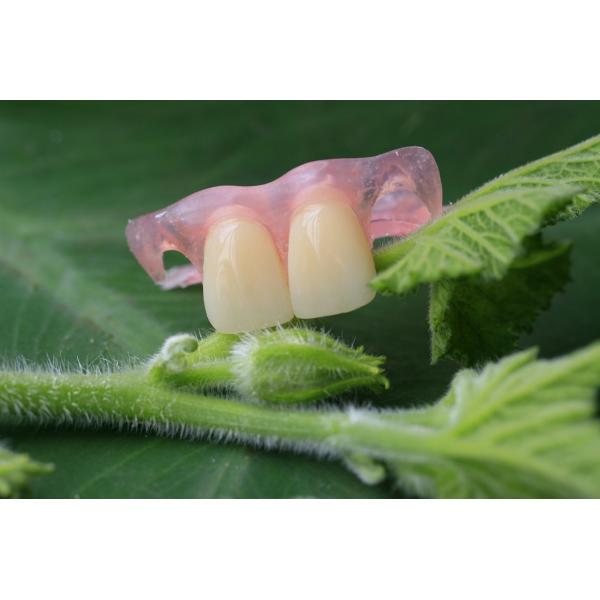 Soft Elastic Nylon Trushine Invisible Denture