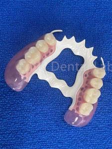 Stain Resistant Removable Dental Partials Stable Replace Missing Teeth Prosthesis