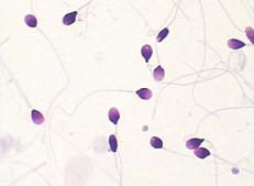 Best BRED-015 Sperm Morphology Staining Kit Diff Quik Rapid Staining Method wholesale