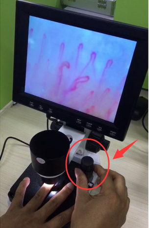 Blood Capillary Microscope For Detecting Body Health , 1 Year Warranty