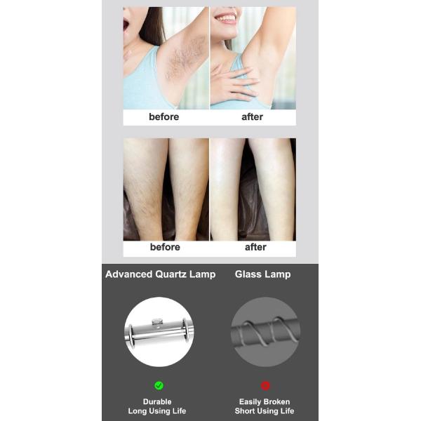 4.2cm2 Skin Pearl IPL Handset