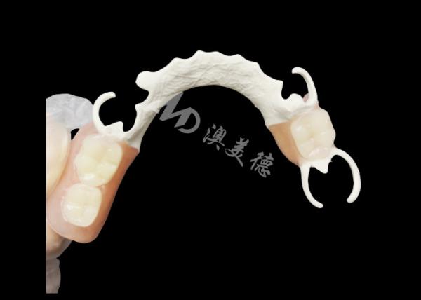 Cheap Custom Cast Partial Denture with HPP framework for Enhanced Chewing and Speech for sale