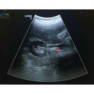 Best GE 4C-RS Curved Array Abdominal Ultrasound Transducer Repair Probe wholesale