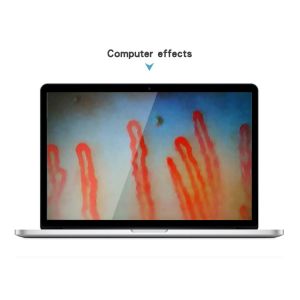 Best Capillary Microcirculation Medical Microscope Magnification Over 380 Times wholesale