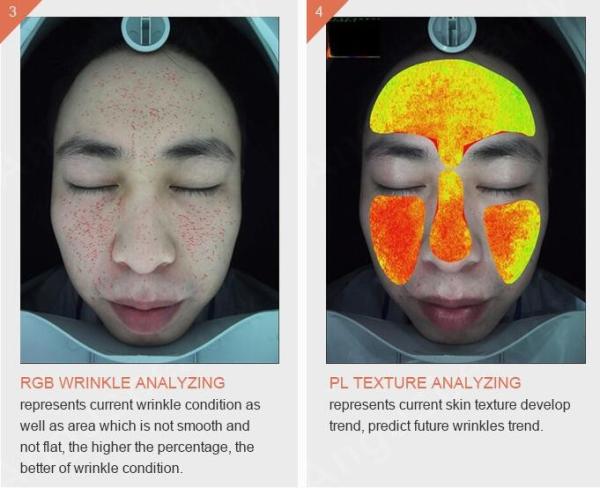 Cheap Handheld Wireless Wifi 3d Skin Analysis Machine Digital With Video Microscope for sale