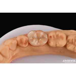 Best High Durability Dental Inlay Onlay Composite Natural Looking Appearance wholesale