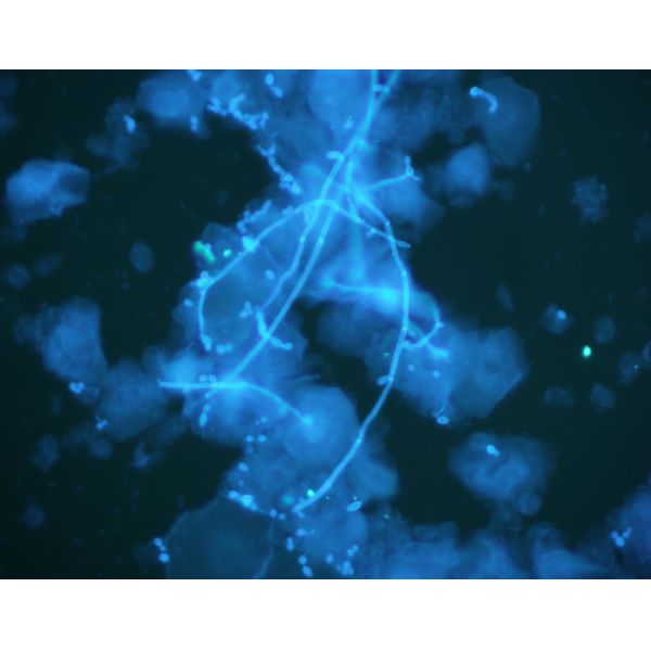 Fungal Fluorescence Stain Fluorescent Dye One Step Method 200Tests