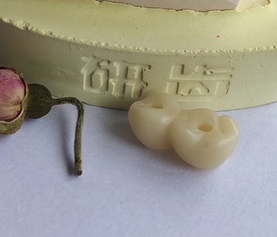 Temporary PMMA Temporary Crown