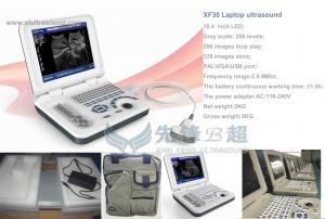 China Medical Home Pregnancy Ultrasound Machine DRF RDA Imaging USB Port on sale