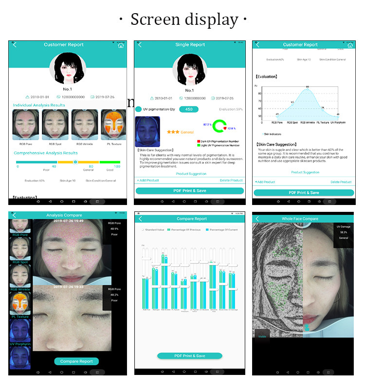 Acne Treatment 3D Skin Analyzer / 9000h Smart Mirror Skin Analysis System