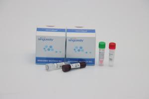 Best Fluorescence Probing PCR Detection Kit Nasal Swab Sample For ADV Adenovirus Testing wholesale